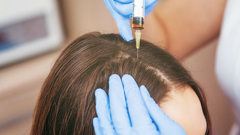 PRP Hair Loss Treatment San Jose | Clarity Medical Spa in San Jose