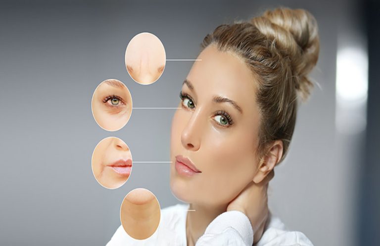 how to get rid of deep nasolabial lines
