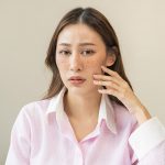 What is Melasma San Jose