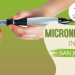 Microneedling in San Jose