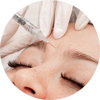 Juvederm® Ultra XC