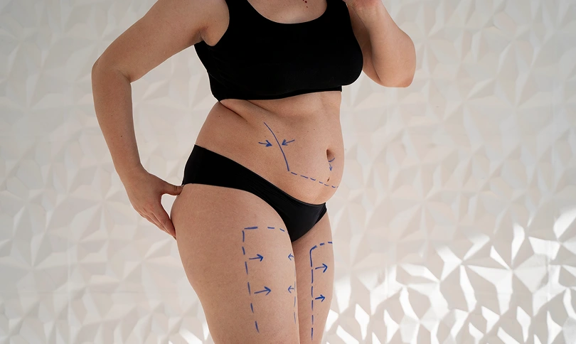 Body Contouring Body Contouring
