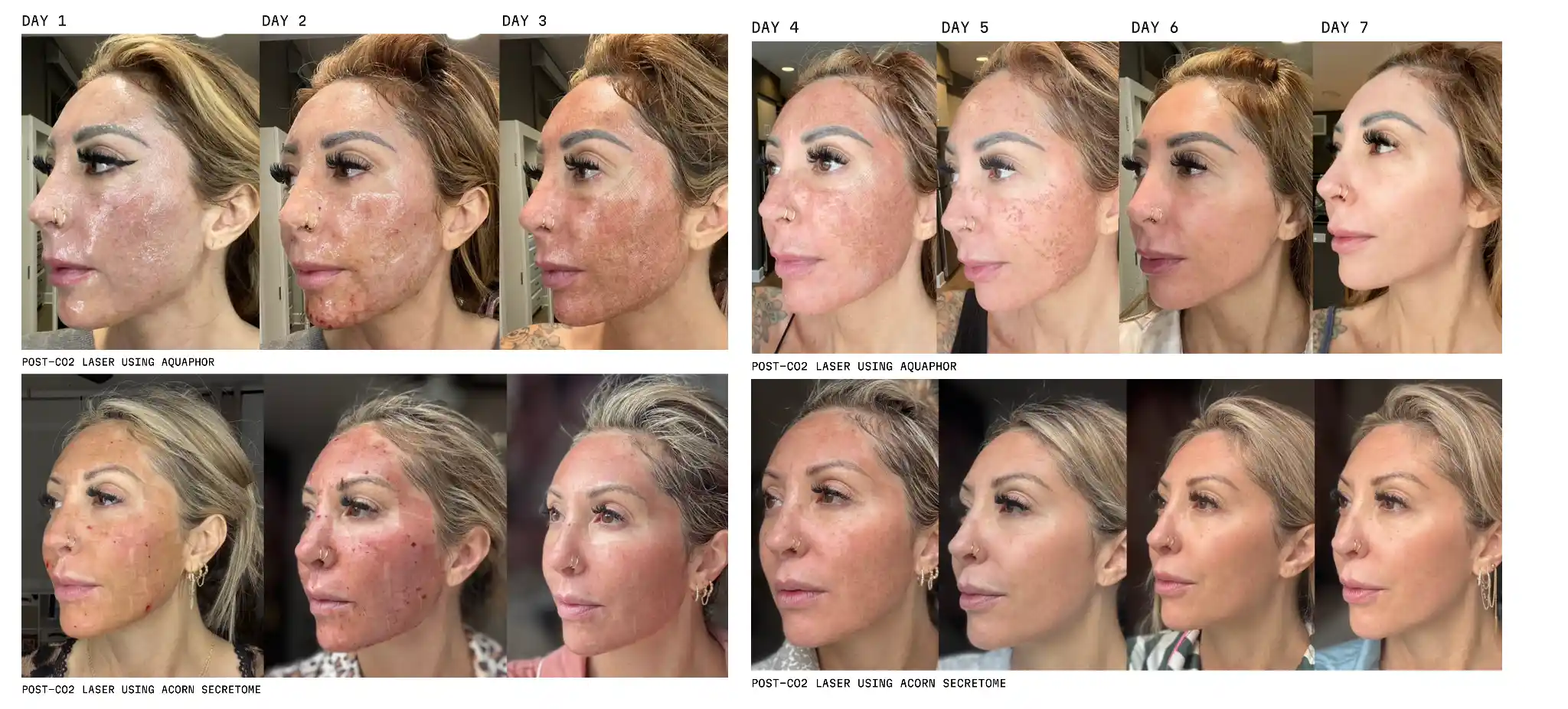 before after CO2 Laser